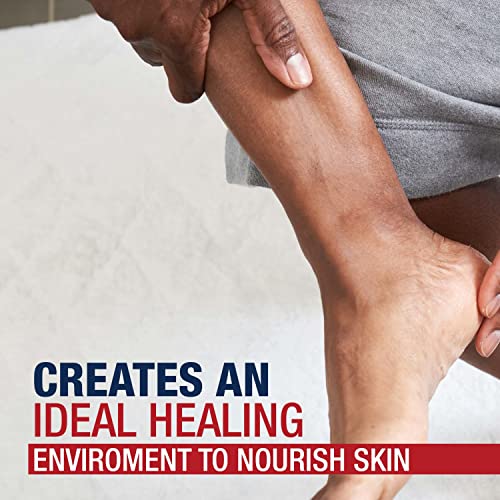 Aquaphor Healing Ointment for Dry, Cracked Skin