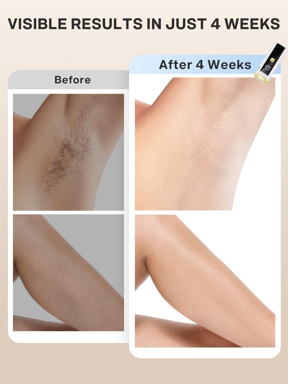 IPL Hair Removal Device for All Body Areas