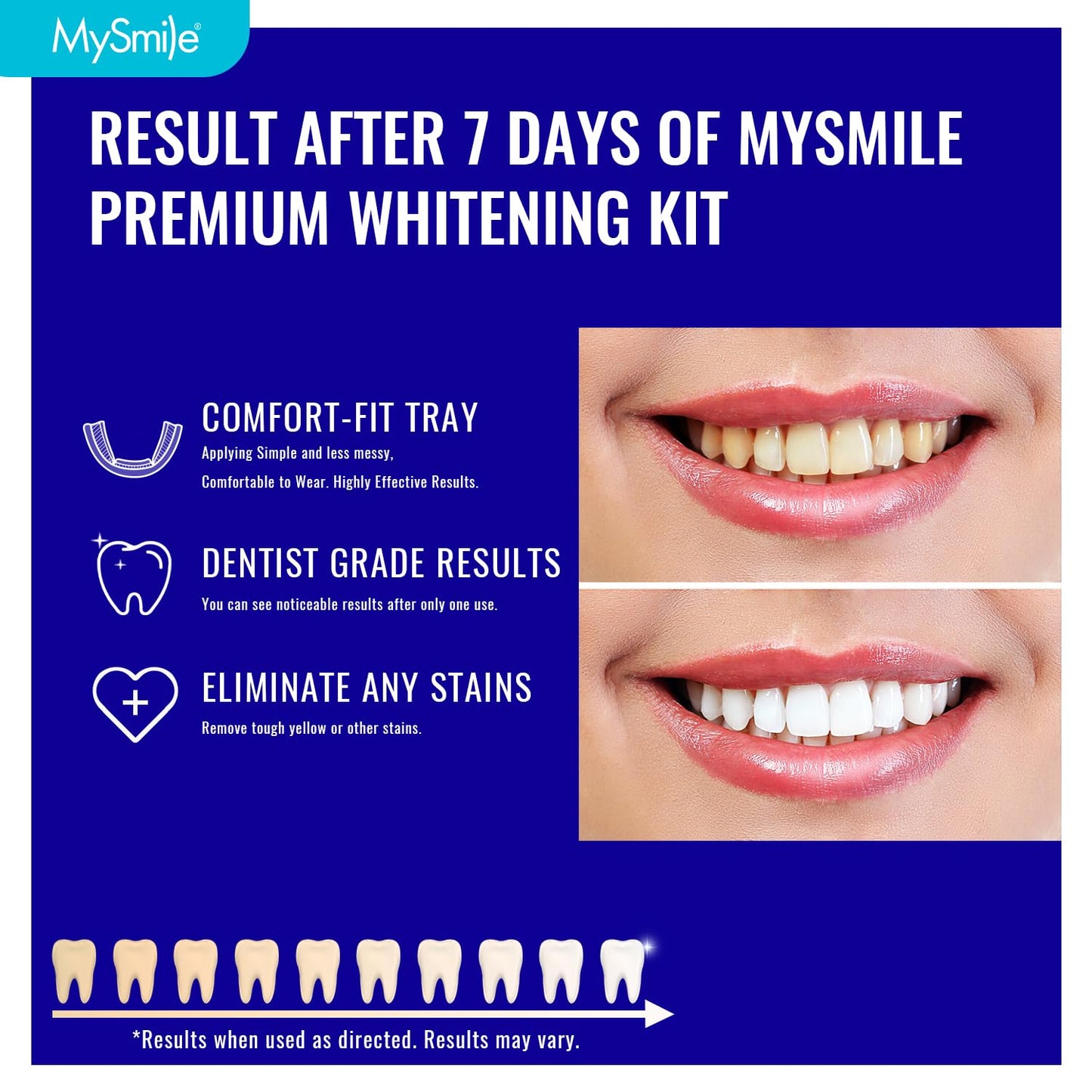 MySmile Teeth Whitening Trays Kit for Sensitive Teeth