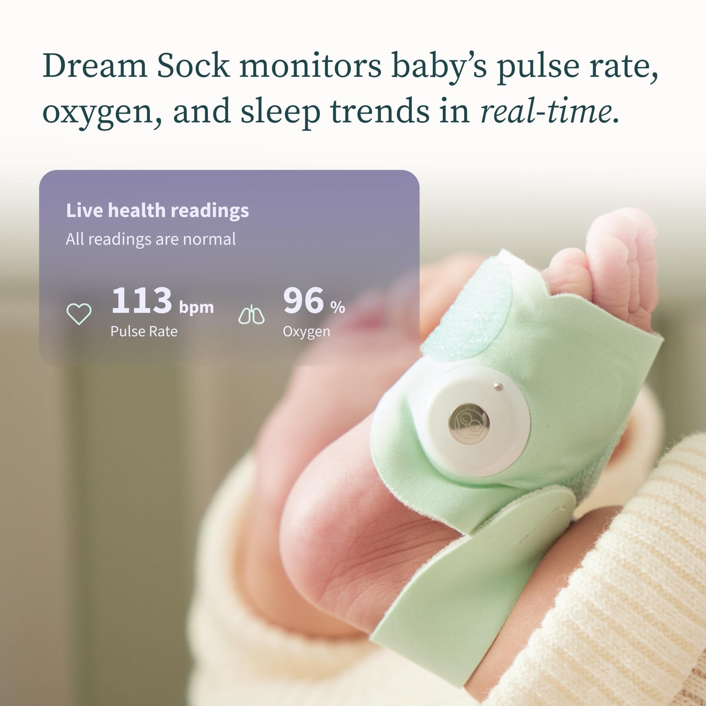 Owlet Dream Sock® Baby Monitor for Infants
