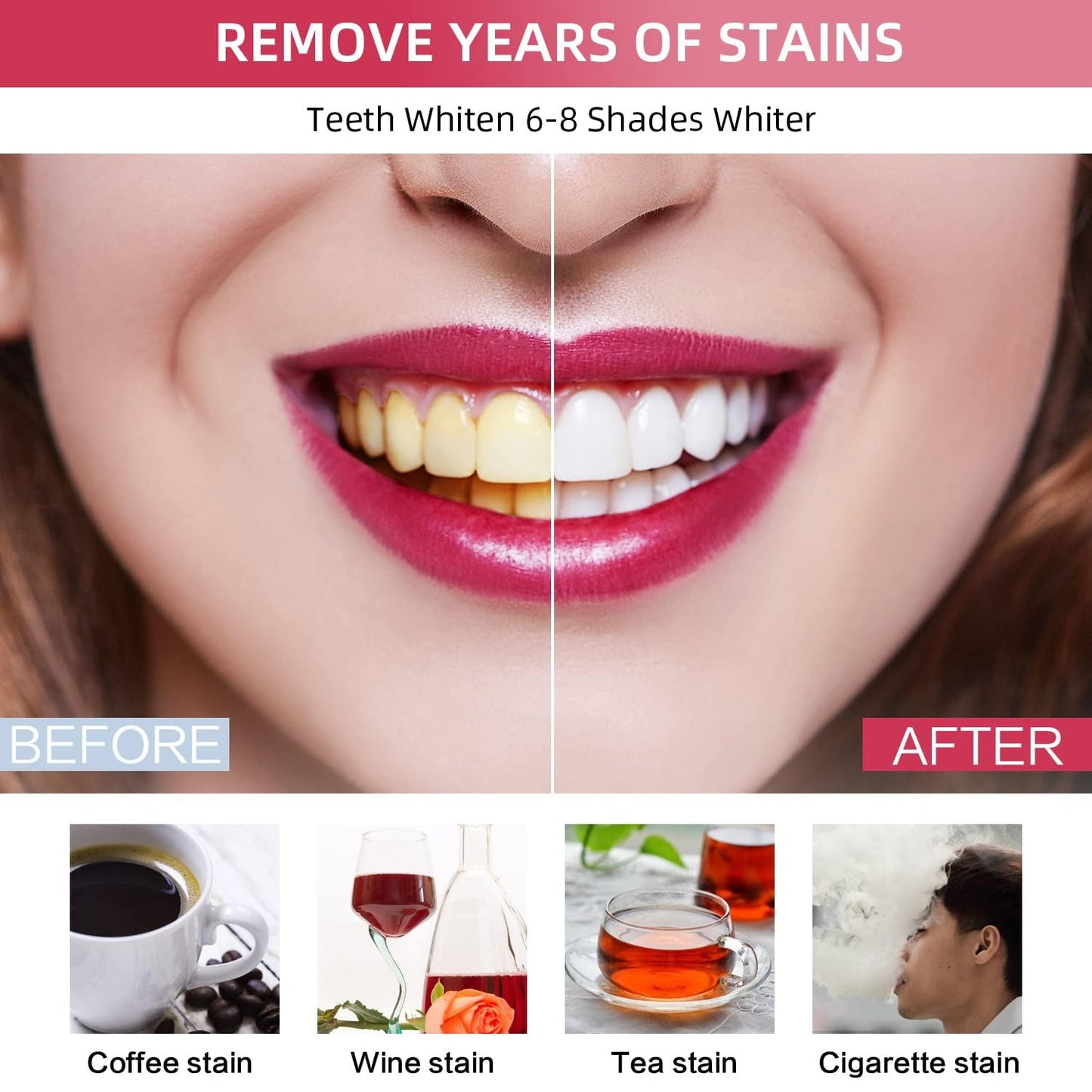Teeth Whitening Kit with LED Light