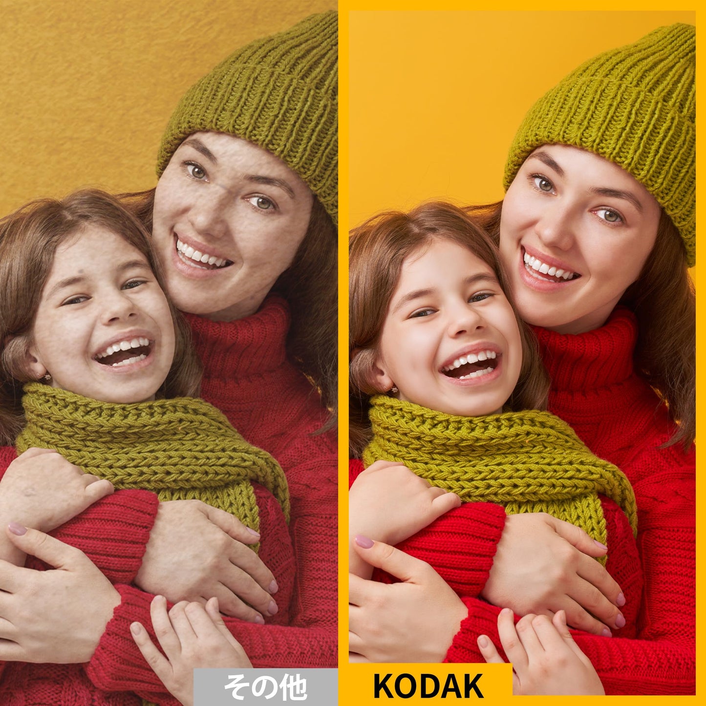 KODAK Mini Shot 2-in-1 Instant Camera Printer