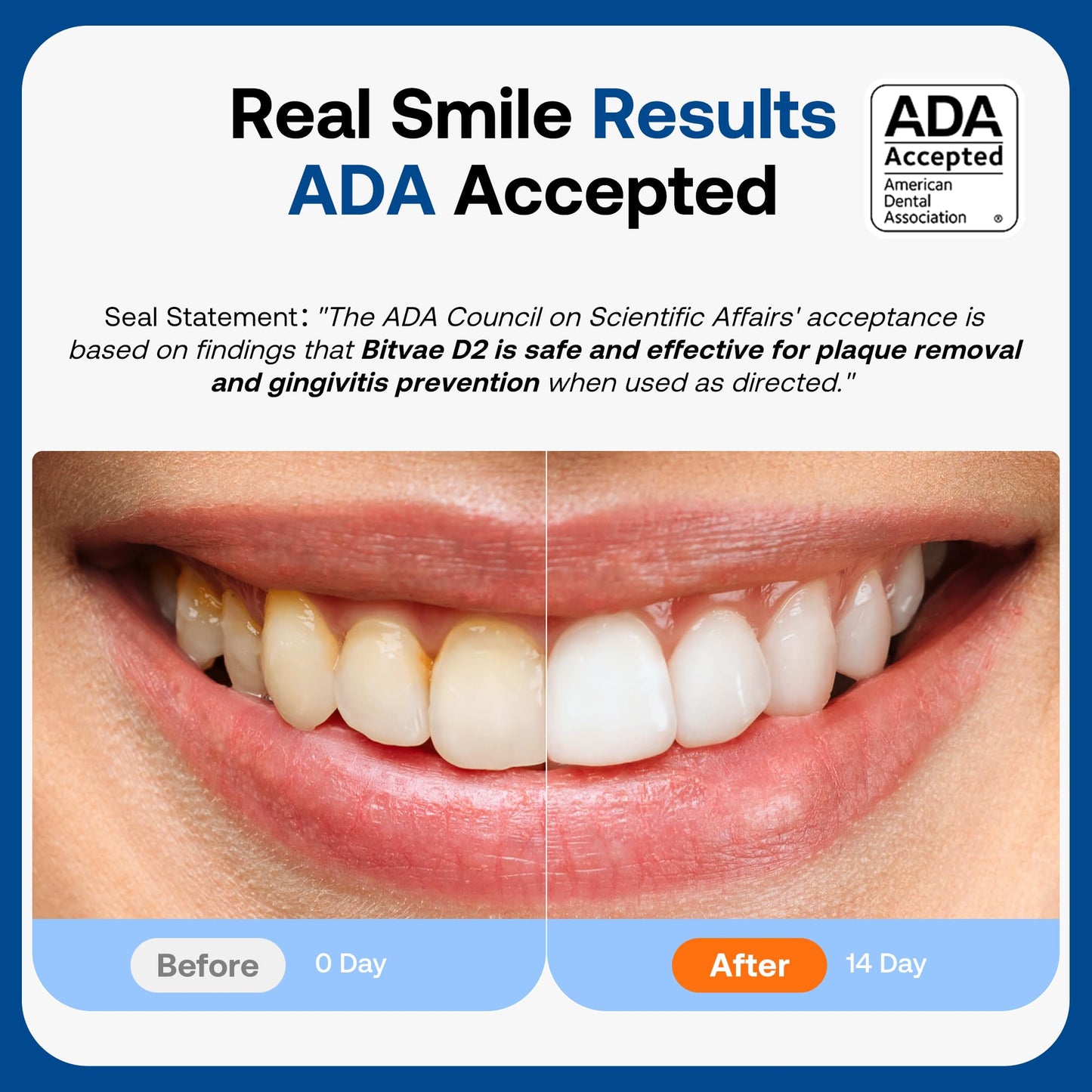 Bitvae ADA Accepted Electric Toothbrush, Travel Toothbrush Rechargeable for Adults and Kids, 60-Day Battery, 5 Modes, 8 Heads, Portable Travel Case & Holder, Shadow Black