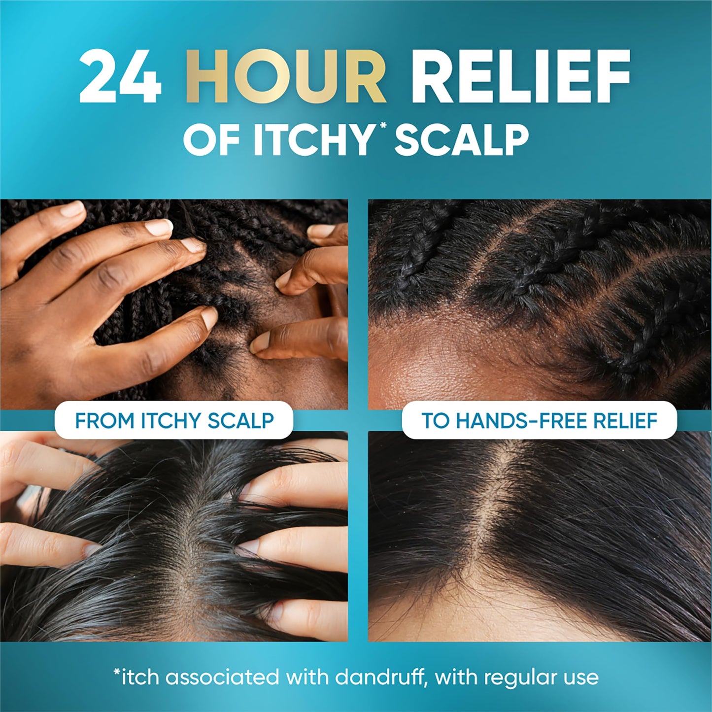 Head & Shoulders Scalp Elixir Treatment for Dandruff
