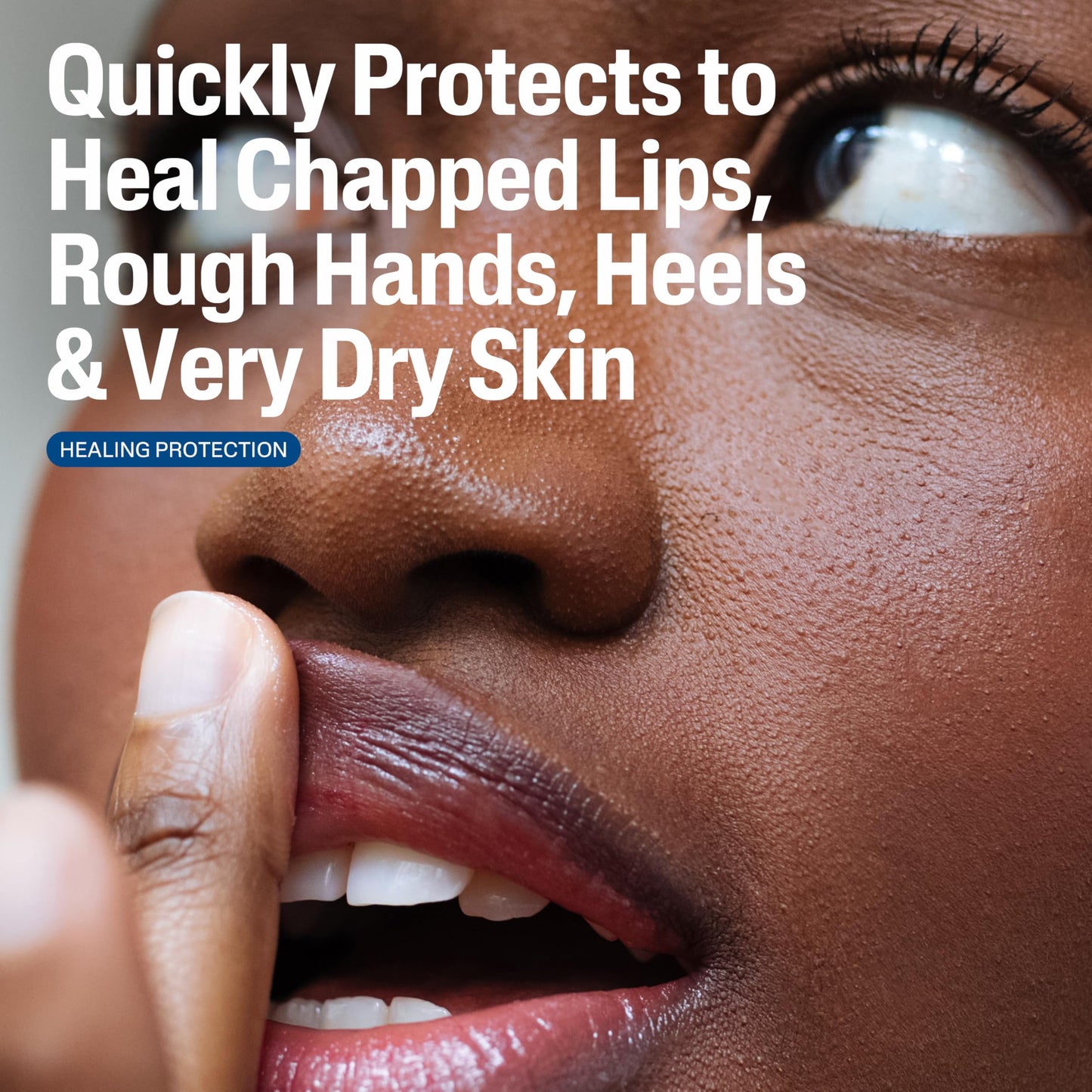 Cetaphil Healing Ointment for Dry, Chapped Skin
