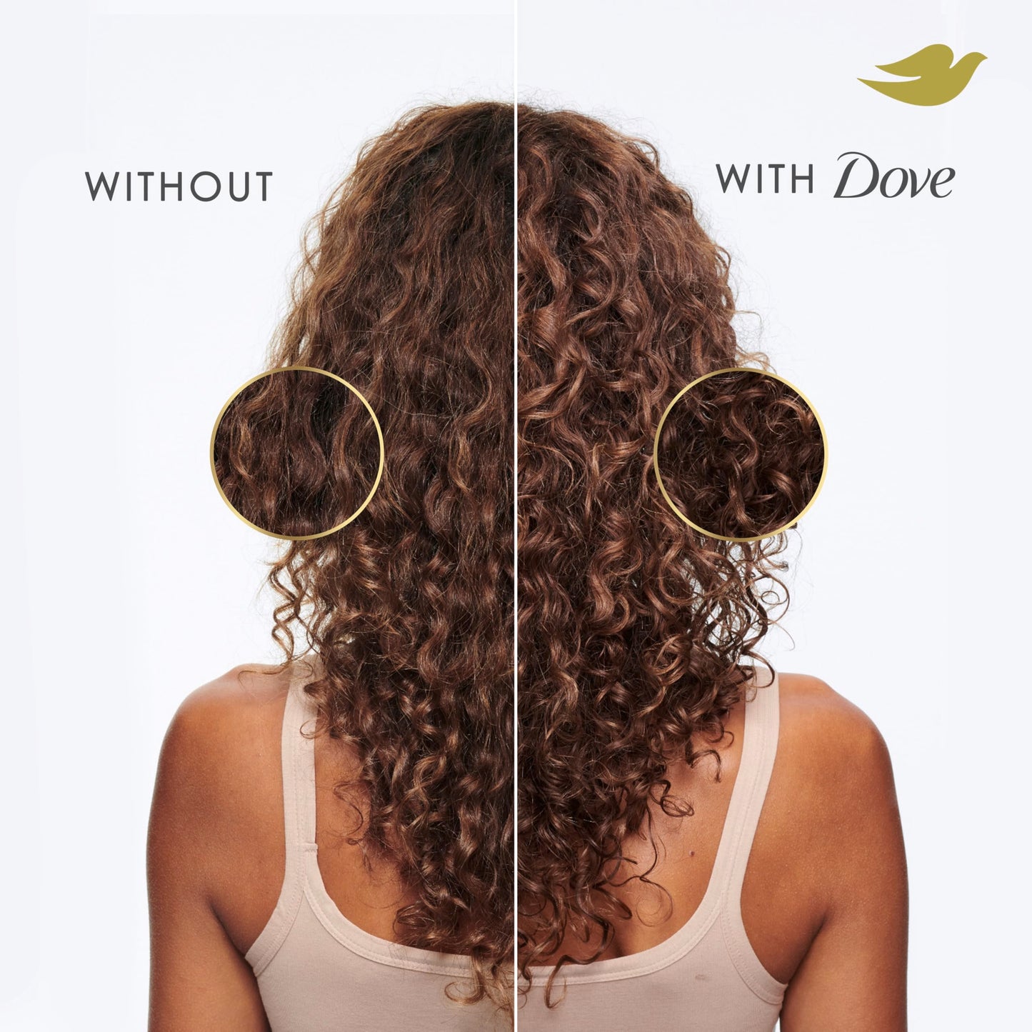 Dove Scalp Care Shampoo for Dryness and Itch