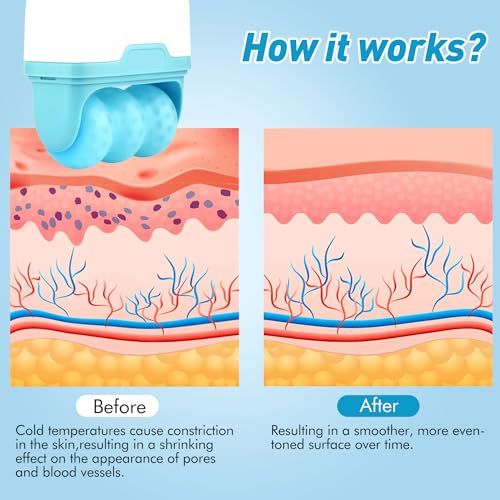 Fronnor Ice Roller for Face,Eyes,Women Gifts Idea,Therapeutic Cooling to Tighten Brighten Complexion and Reduce Wrinkles,Massager Under Eye Puffiness,Migraine and Pain Relidf
