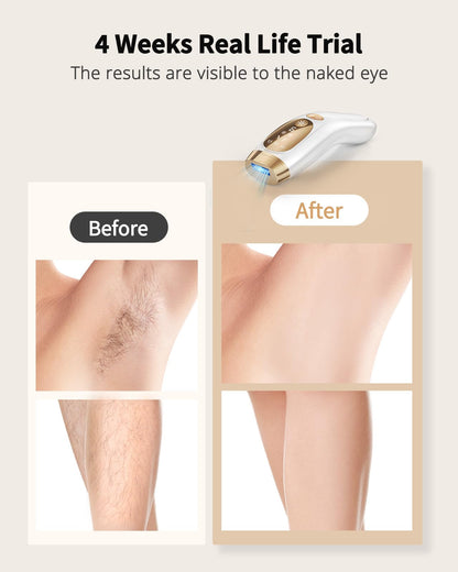 UENMOON Laser Hair Removal for Women and Men - IPL Hair Removal with Ice-Cooling System for Painless & Long-Lasting Result, Whole Body Hair Removal