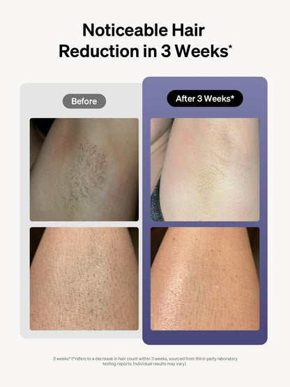Ulike Laser Hair Removal for Women and Men, Air 3 Ice-Cooling IPL Device Hair Removal for Nearly Painless & Long-Lasting Results, 3 Modes & Auto Flashing for Fast Full Body Hair Removal from Home