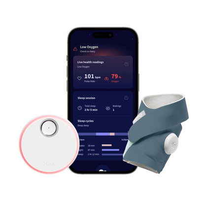 Owlet Dream Sock® Smart Baby Monitor