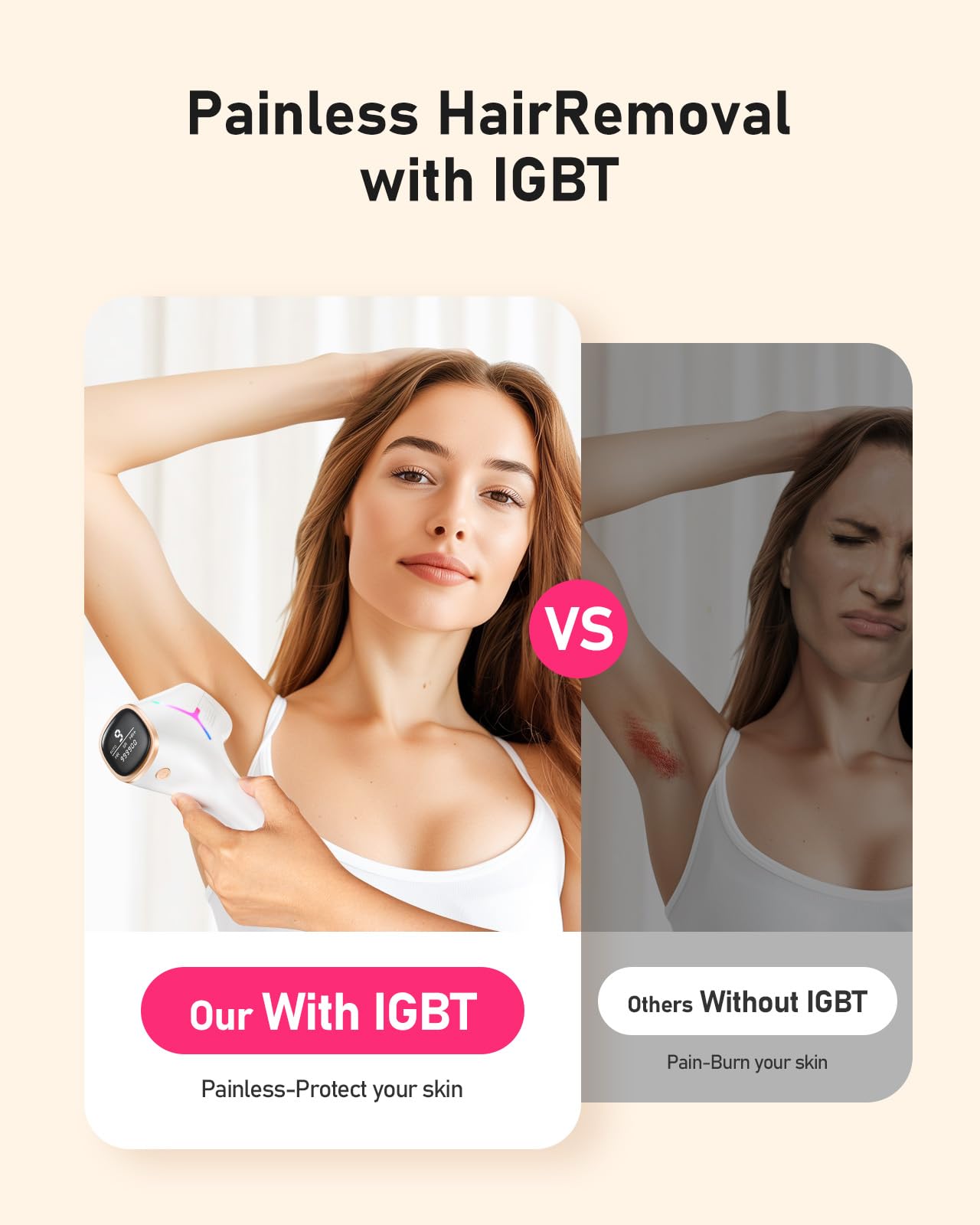 LYSMOSKI IPL Laser Hair Removal Device for Home