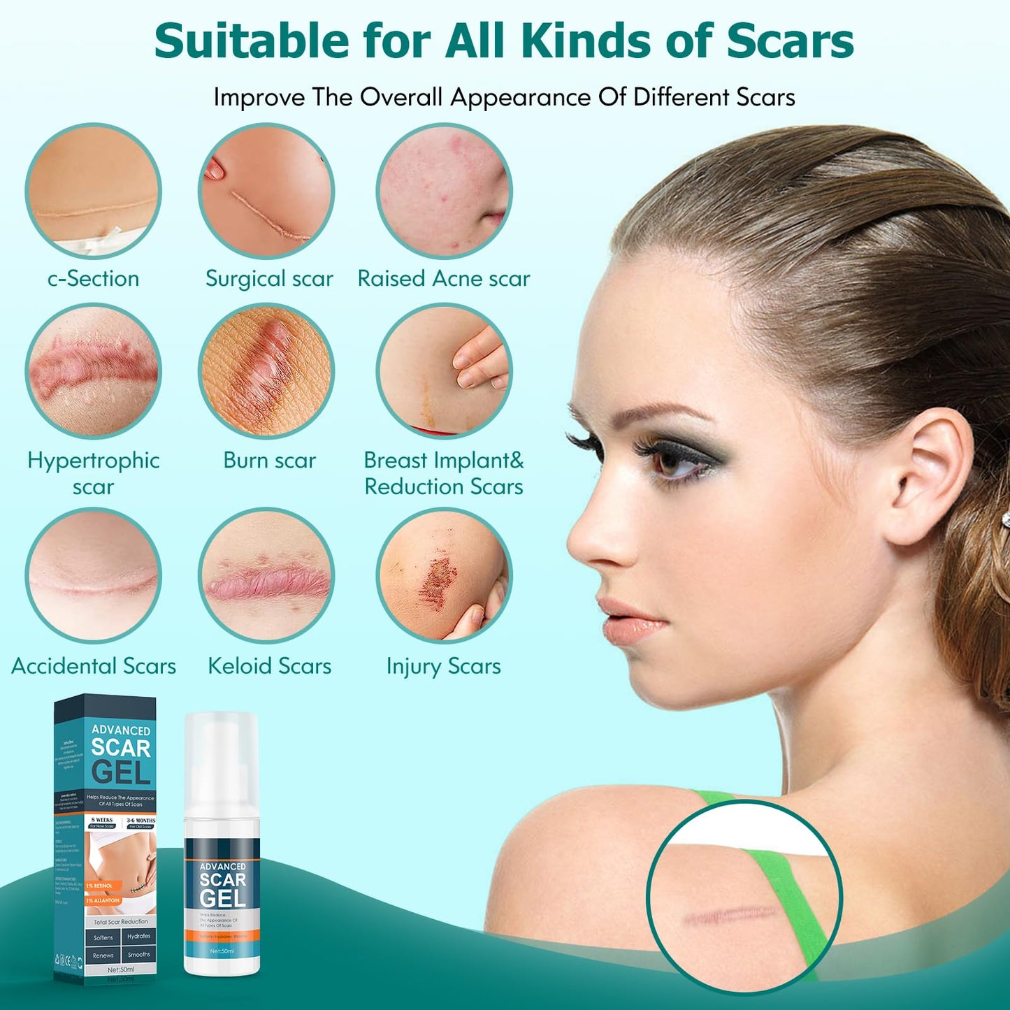 Gowgaw Scar Gel, Scar Cream, Advance Scar Gel for Surgical Scars,Face,Body,Leg, Burns, Acene,C-Section, Stretch Marks, Keloids,Scar Treatments for Old & New Scars,Scar Removal for Women Men,1.76oz