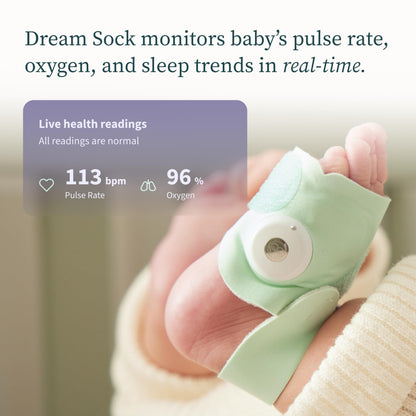 Owlet Dream Sock® Baby Monitor for Infants