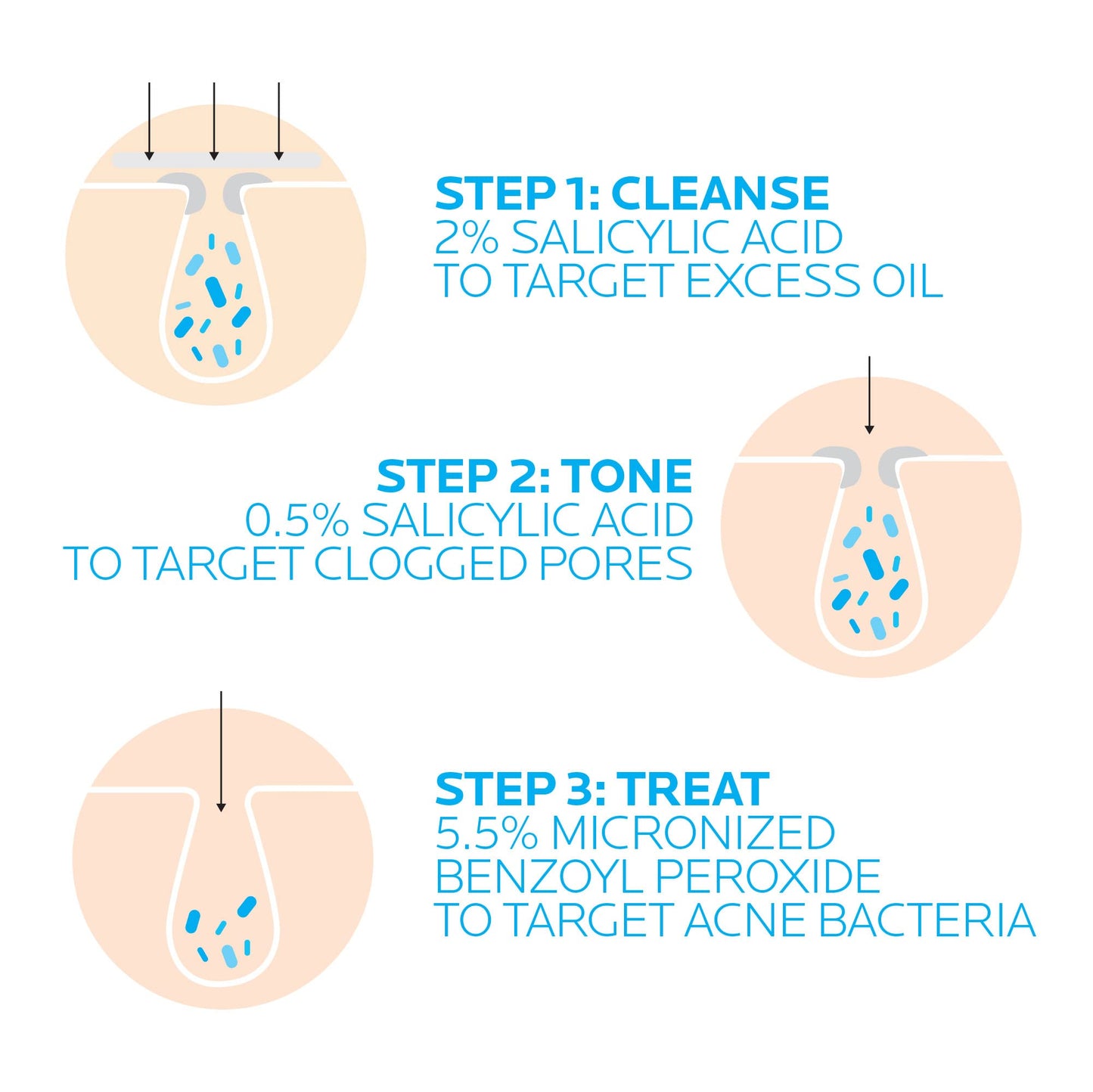 La Roche-Posay 3-Step Acne Treatment System