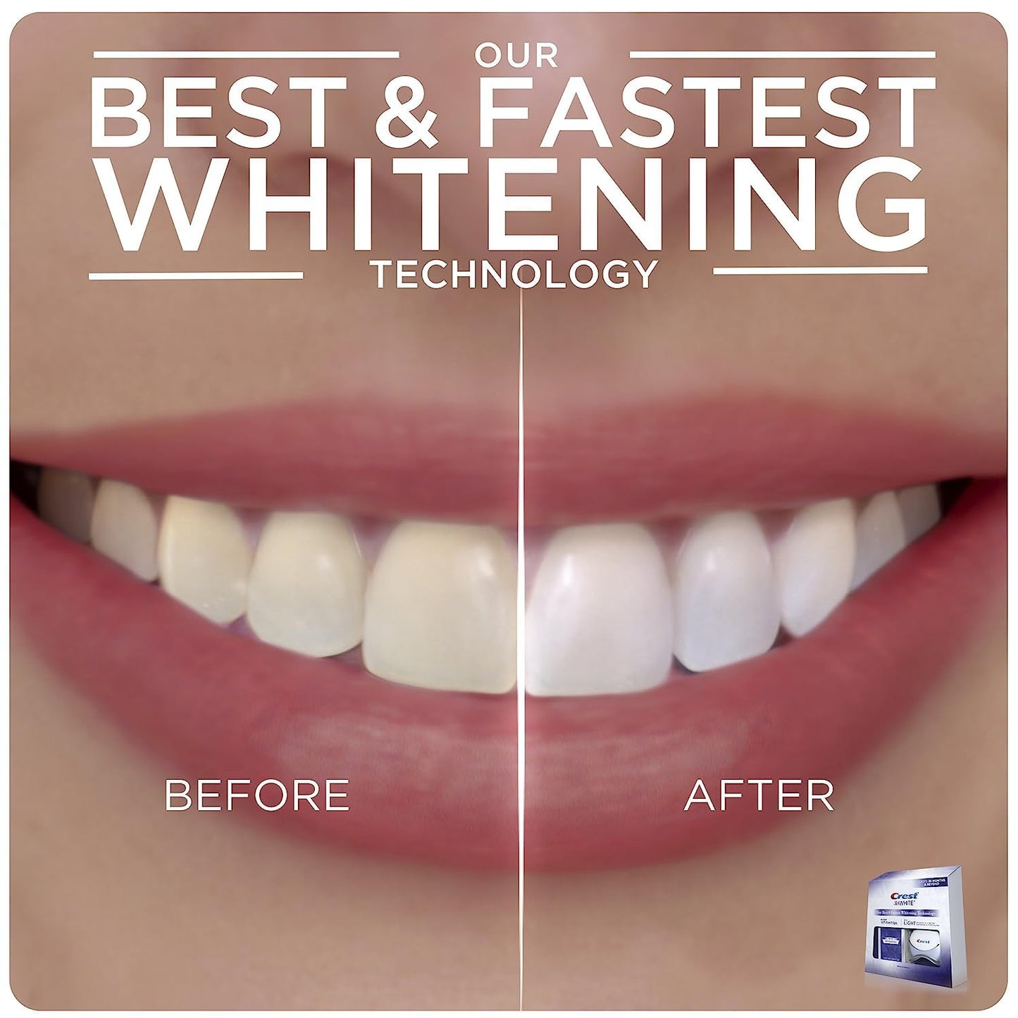Crest 3D Whitestrips Teeth Whitening Kit, 20 Strips
