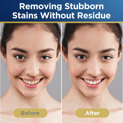 Teeth Whitening Strip, Whitening Strips, 42 Strips for Sensitive Teeth, Professional and Safe Teeth Whitening Kit