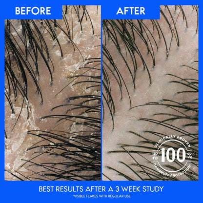 Head & Shoulders Anti-Dandruff Shampoo Twin Pack
