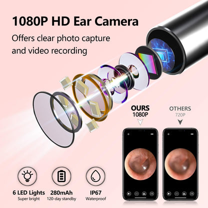 Joygift Ear Wax Removal Kit with Camera,1080P Earpick,with IP67 Waterproof Lens,6 LED Lights,8Pcs Ear Care Kit for Daily Use,Wireless Visual Ear Scoop Tool for Android and iPhone Tablets,Pink